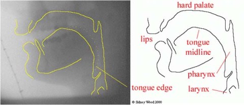 Tracing X-ray profiles