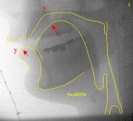 Scanned 600dpi, colour positive, greyscaleFlipped horizontalLevels (mid 1.50)