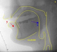 Scanned 600dpi, colour positive, greyscaleFlipped horizontalLevels (mid 1.50)